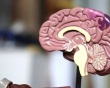 Tai biến mạch máu não ảnh hưởng đến não phải và não trái ra sao?