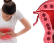 Một số bệnh phụ khoa có thể làm tăng nguy cơ bệnh tim và đột quỵ?