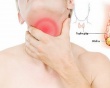 Có những loại bướu tuyến giáp nào?