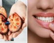 Từ chảy máu chân răng đến nguy cơ tổn thương thận