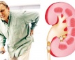 Suy thận mạn ở người cao tuổi: Làm sao để giữ thận khỏe lâu hơn?