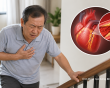 Hẹp mạch vành 50 - 70% có bắt buộc phải đặt stent không?