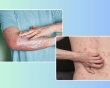 Mẹo chăm sóc da cho người bệnh vảy nến thể mảng