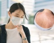 Người lớn cũng bị sởi: Bà bầu cần lưu ý gì?