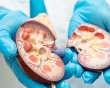 Đái tháo đường biến chứng thận: Dấu hiệu và cách kiểm soát