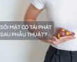 Sỏi mật có tái phát sau phẫu thuật không?