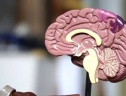Tai biến mạch máu não ảnh hưởng đến não phải và não trái ra sao?