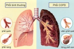 Điều trị hen và phổi tắc nghẽn mạn tính bằng đông y