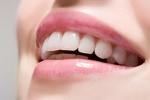 Những ai không nên tẩy trắng răng?