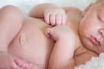 Trẻ sơ sinh không rụng rốn có phải bị mắc bệnh?