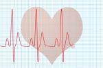 Rối loạn nhịp tim có chữa khỏi không?
