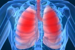 Ứng dụng tế bào gốc trị bệnh phổi tắc nghẽn mạn tính