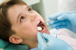 Có nên nhổ răng sữa ở trẻ em?