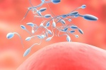 Tinh trùng bị đứt gãy ADN: Dễ vô sinh, con dị tật