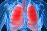 Video: Các triệu chứng của bệnh ung thư phổi