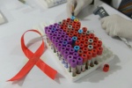Vaccine HIV mới mang lại hy vọng cho bệnh nhân toàn cầu
