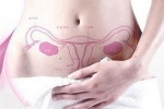 5 dấu hiệu của ung thư nội mạc tử cung