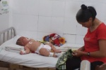 Bé trai 5 tháng tuổi bị nghi nhiễm viêm màng não mô cầu đầu tiên ở Đắk Lắk