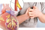 Phẫu thuật bắc cầu nối động mạch vành có nguy hiểm không?