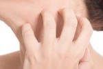 Thường xuyên ngứa ngáy, nổi mề đay phải điều trị như thế nào?