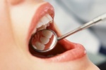 7 loại thực phẩm giúp ngăn ngừa chảy máu chân răng