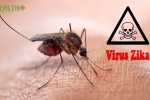 Virus Zika, tật đầu nhỏ ở trẻ, viêm tủy ở người lớn liên quan thế nào?