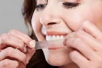 Tẩy trắng răng tại nhà quá nhiều có an toàn không?