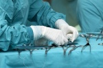 U xơ tử cung: Phẫu thuật cắt bỏ tử cung không phải là giải pháp duy nhất!