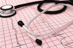 Những điều cần biết về rung tâm nhĩ - Rối loạn nhịp tim bất thường