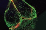 Phát hiện mạch bạch huyết chưa từng thấy trong não người
