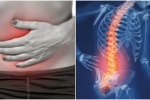 Tư vấn miễn phí viêm dạ dày do nhiễm HP và bệnh lý đau lưng