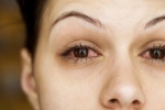 15 nguyên nhân khiến mắt bạn bị đỏ thường xuyên