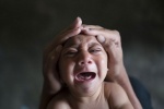 Virus Zika ở Việt Nam ít có khả năng gây dị tật đầu nhỏ cho trẻ sơ sinh