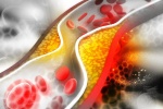 Cholesterol tốt: Thừa hay thiếu đều có thể gây tử vong sớm