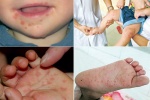 3 cách vệ sinh sai khiến dễ mắc cúm, tay chân miệng