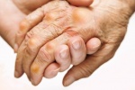 Biện pháp giảm đau khớp khi bệnh gout “hoành hành”