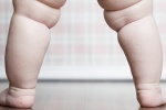 Sinh mổ khiến trẻ tăng nguy cơ bị béo phì