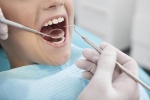 Có nên nhổ răng hàm bị sâu?
