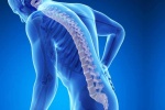 5 phương pháp tự nhiên giúp phòng ngừa chứng loãng xương