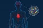  Bệnh Parkinson có thể bắt nguồn từ các vi khuẩn trong ruột