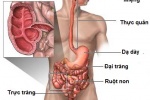 5 dấu hiệu của bệnh Crohn bạn nên biết