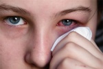 3 bệnh dị ứng ở mắt gây suy giảm thị lực
