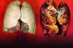 Thuốc lá gây hại cho phổi ra sao?