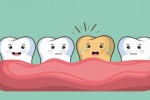 Bạn có thể làm gì để ngăn chặn các vết ố trên răng?