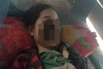 Thiếu nữ 18 tuổi bị phá hủy khuôn mặt sau khi nhổ 1 chiếc răng và đây là nguyên nhân