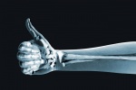 Bổ sung magne có thể ngăn ngừa gãy xương ở người cao tuổi