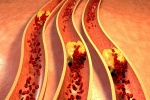 Cách giảm cholesterol đơn giản từ bột yến mạch và hạnh nhân