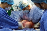 ​Phẫu thuật cắt khối u buồng trứng nặng 12 kg