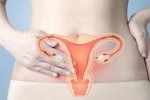 Lạc nội mạc tử cung có thể gây ung thư ở phụ nữ