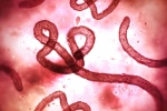 Thêm 2 trường hợp nghi ngờ nhiễm Ebola tại Congo